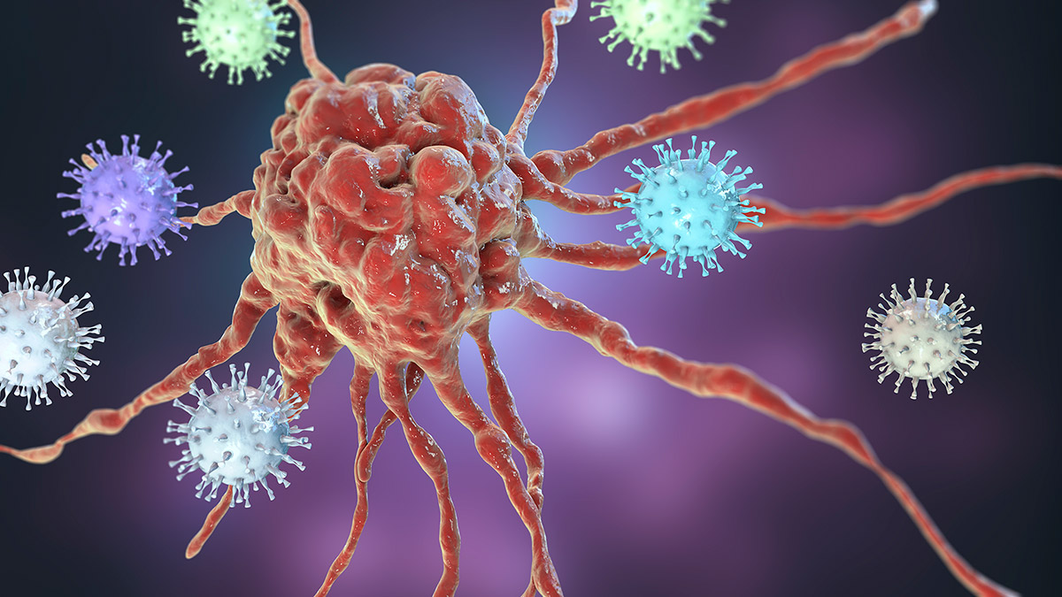 항산화제 요법(셀레늄 등)